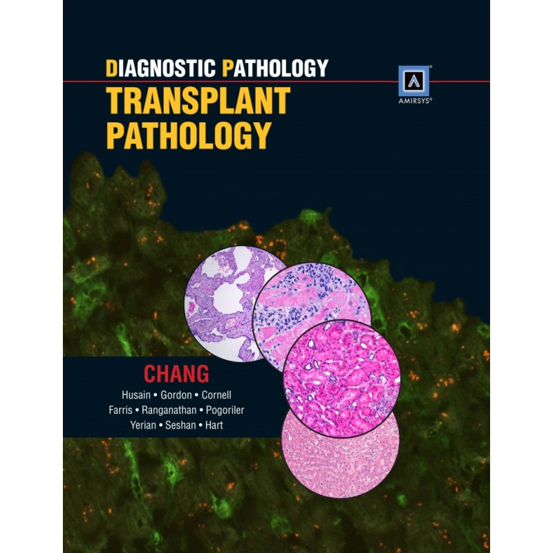 Diagnostic Pathology: Transplant Pathology, Published by Amirsys